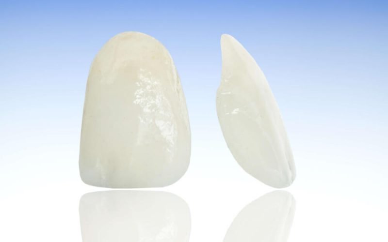 Blanqueamiento mataró