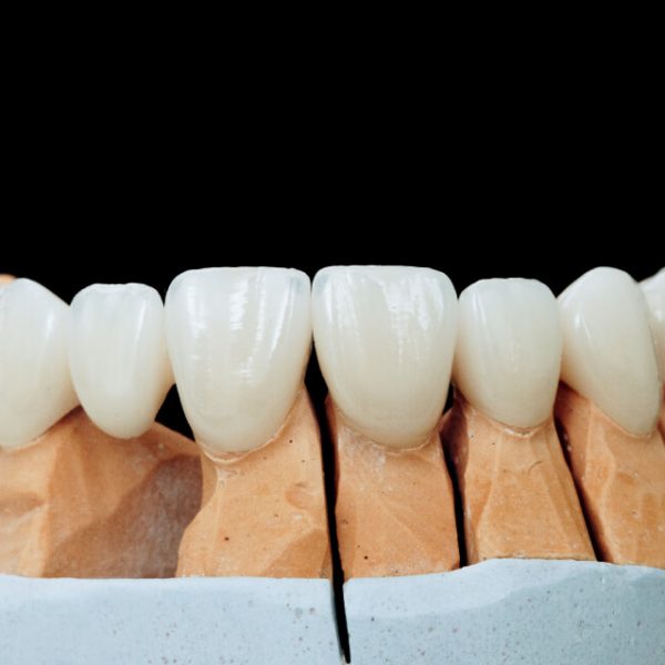 Estética dental tratamiento