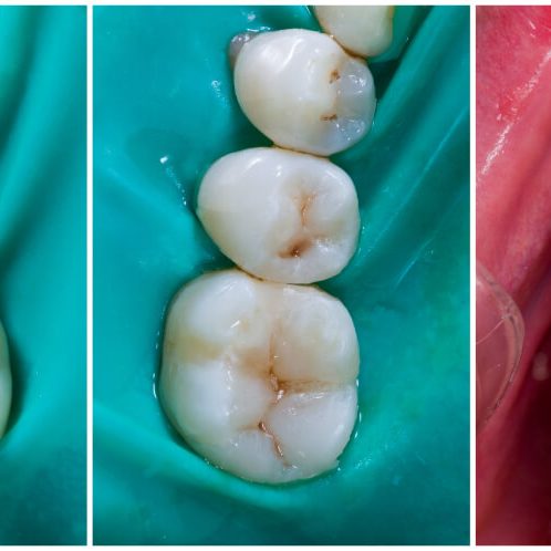 Odontología restauradora en mataró