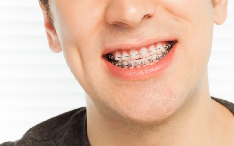 Ortodoncia Quatredental