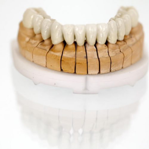 mataró rehabilitación oral