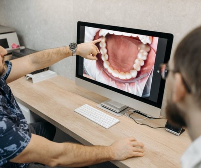 Mordida torcida mordida torcida causas