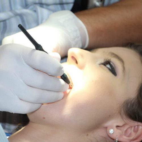 dispositivo avance mandibular mataró