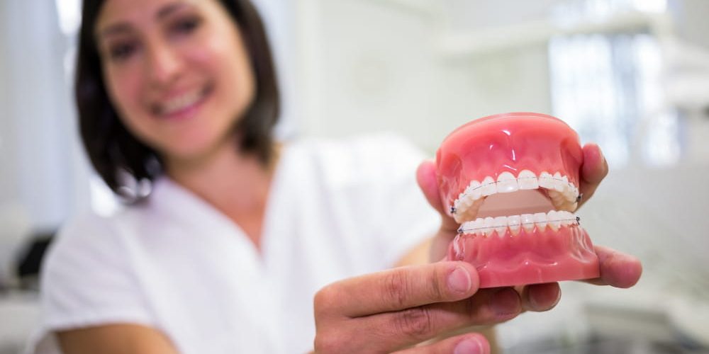 dentadura quatre dental